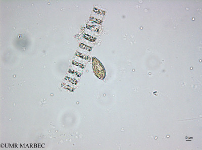 phyto/Brazilian_Amazon_coast/Amazomix_station_22/AMAZOMIX September 2021/Prorocentrum micans et Skeletonema sp4 (St22_220909_001_ovl-34).tif(copy)_thumb.jpg